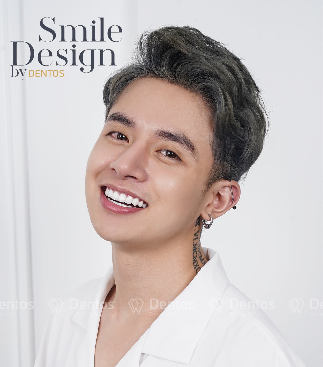 Đừng ngại kết nối với đội ngũ chuyên gia của Dentos để được tư vấn bọc răng sứ thẩm mỹ